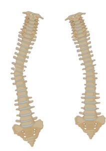 Curved scoliosis spines